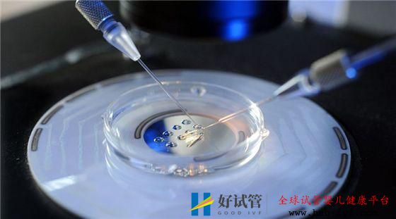 多囊卵巢综合症能做试管婴儿吗？(图2)