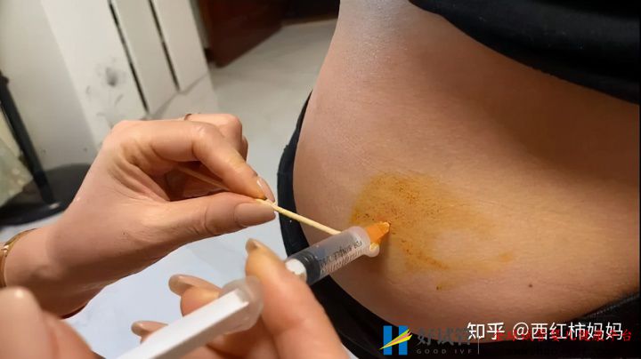 为何许多过来人不建议女性做“试管婴儿”背后真...(图3) 为何许多过来人不建议女性做“试管婴儿”背后真...(图3)