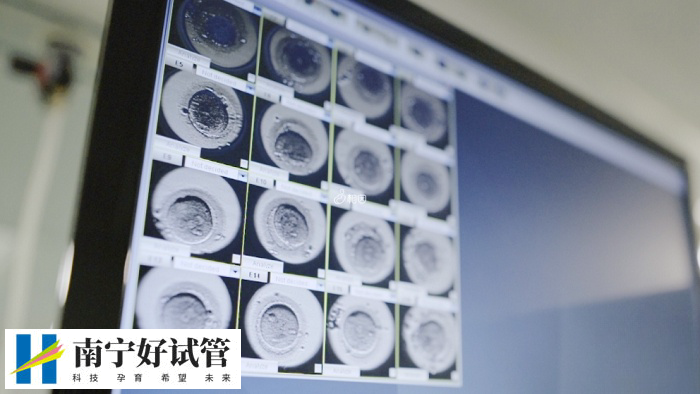 试管婴儿取卵流程(图1)