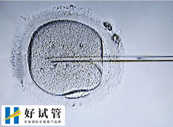 6aa囊胚的成功有60%